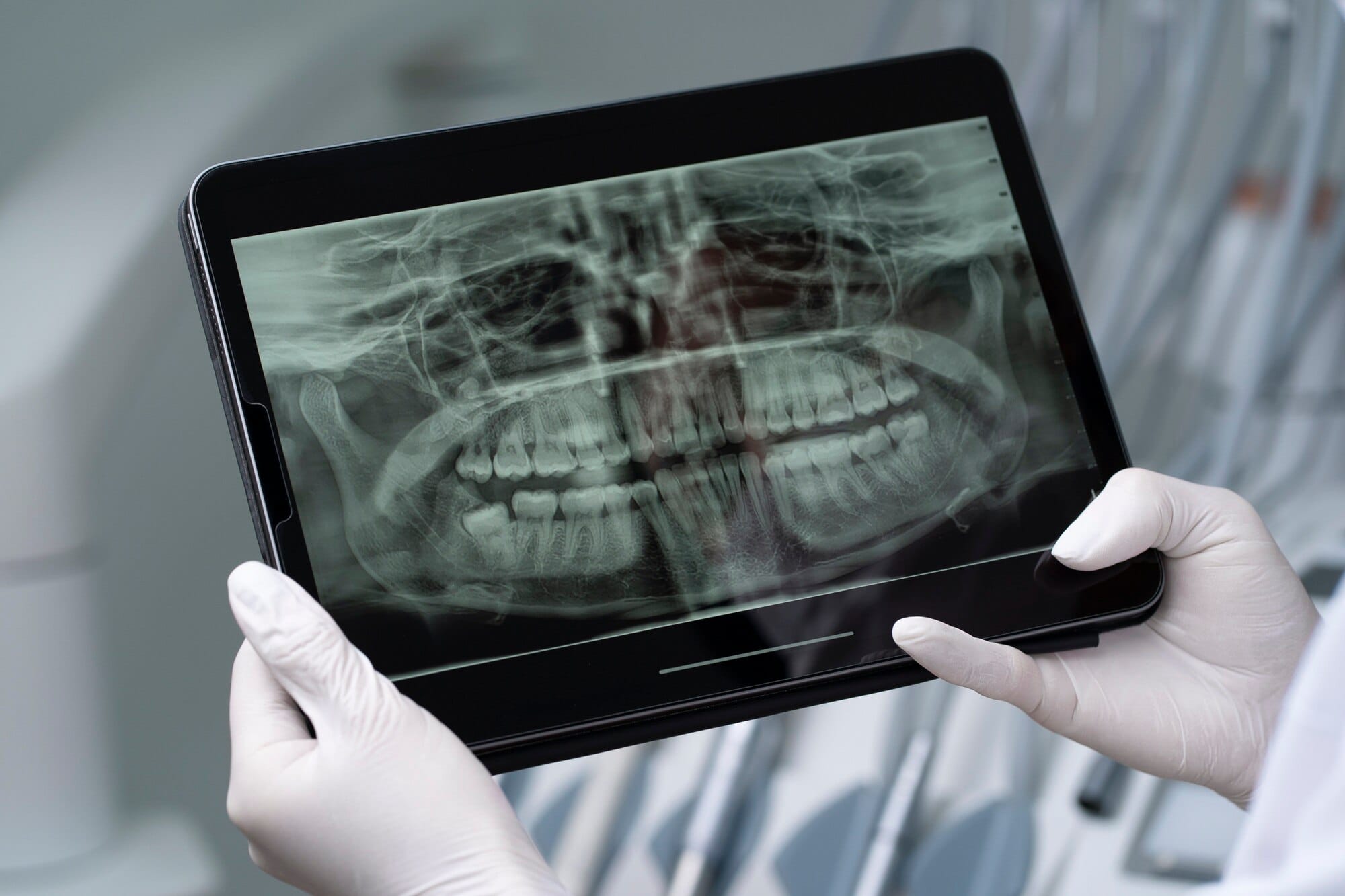 Oral cancer screening