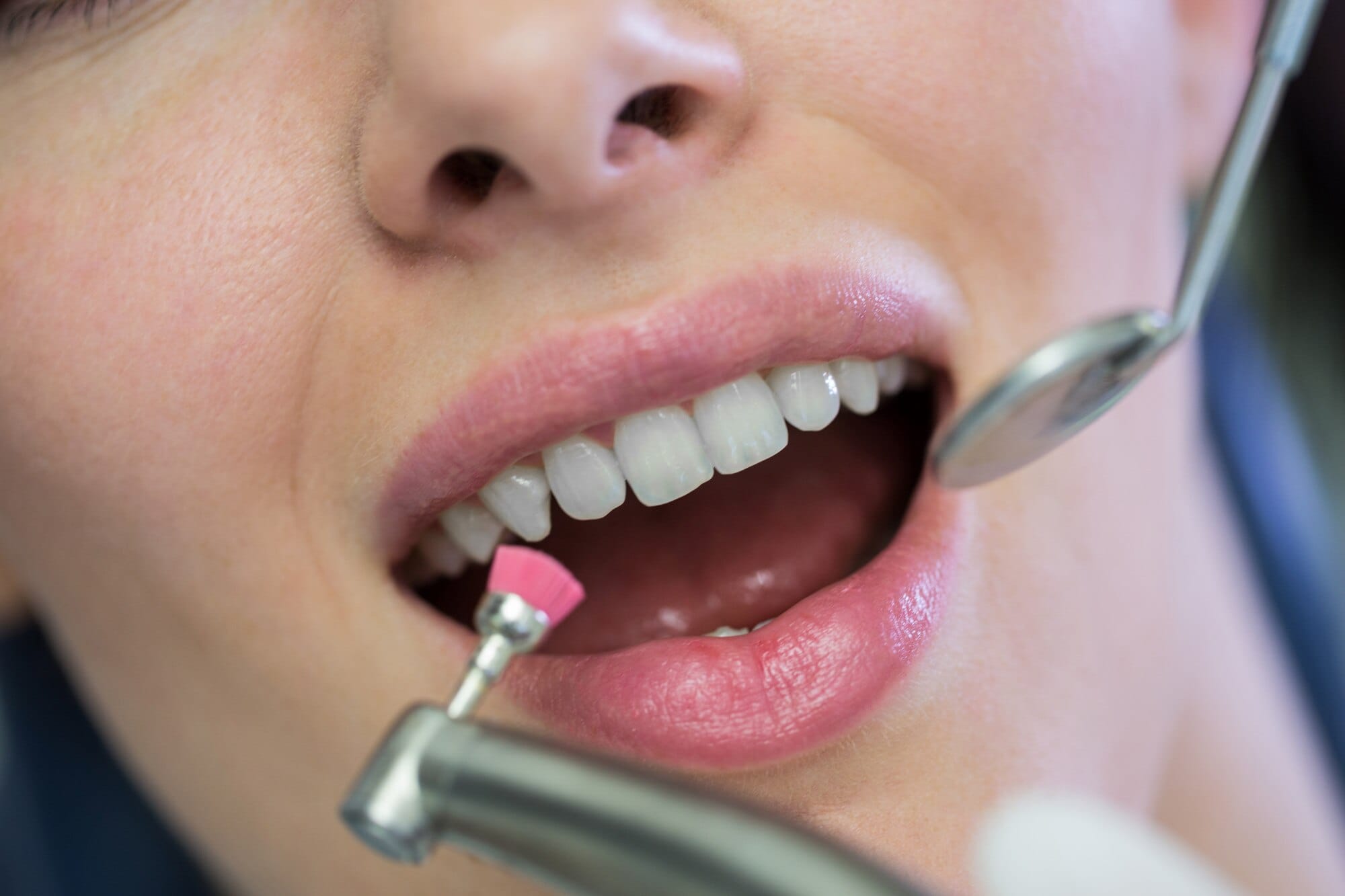 Dental Hygiene Maintenance
