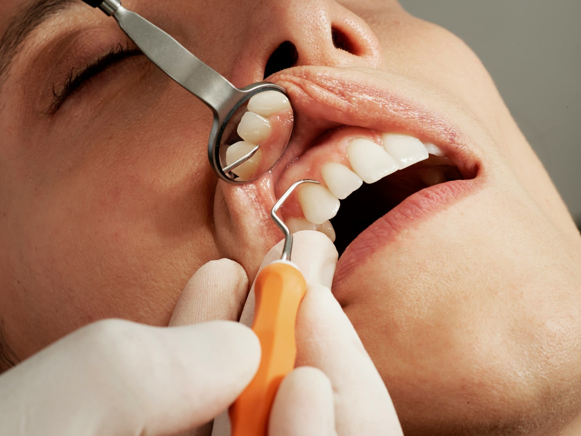 Gum disease treatment